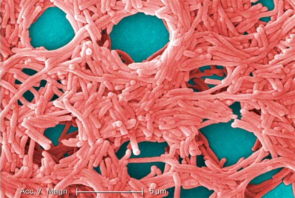 Legionella pneumophila baktérium